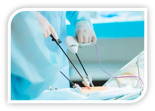 Cirurgia por Videolaparoscopia Cirurgia por Videolaparoscopia